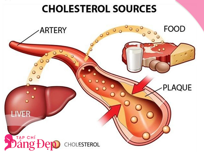 Cholesterol là gì? Mức bao nhiêu bắt đầu gây hại cho sức khỏe