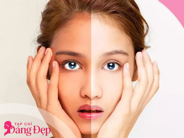 Glutathione là gì? Sự thật về công dụng trắng da đang được lan truyền