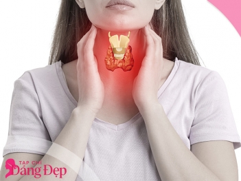 Cường giáp là gì? Triệu chứng dễ gặp khi tuyến giáp hoạt động quá mức - Tạp chí Dáng Đẹp