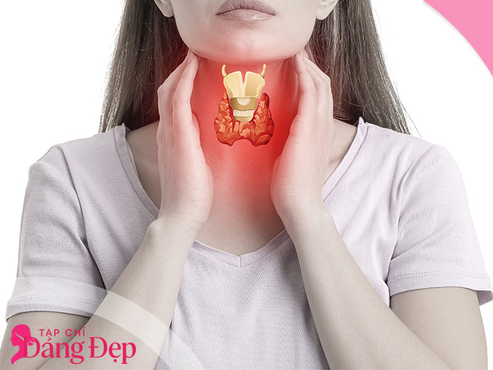 cường giáp là gì